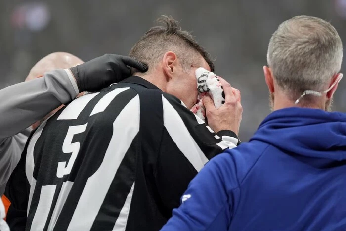 NHL-Schiedsrichter beendet das Spiel vorzeitig nach einem Schlägerstoß ins Gesicht